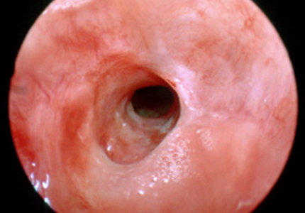 ppt-second_slide_top_right